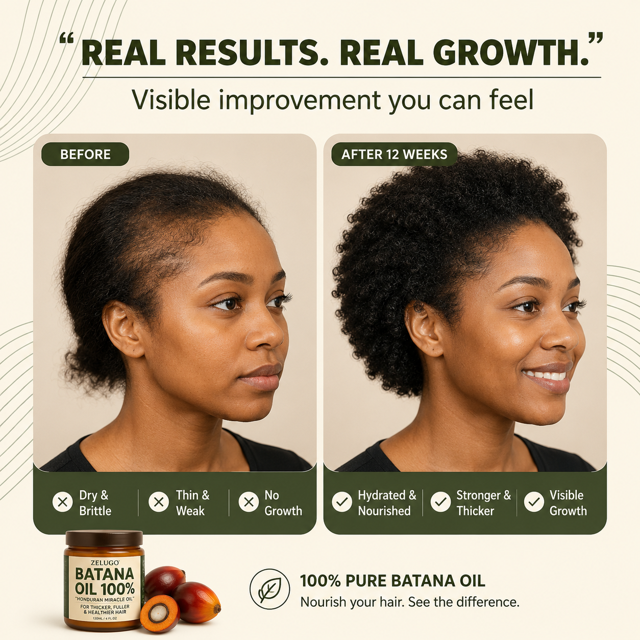 Bantana Natural Hair Growth Oil